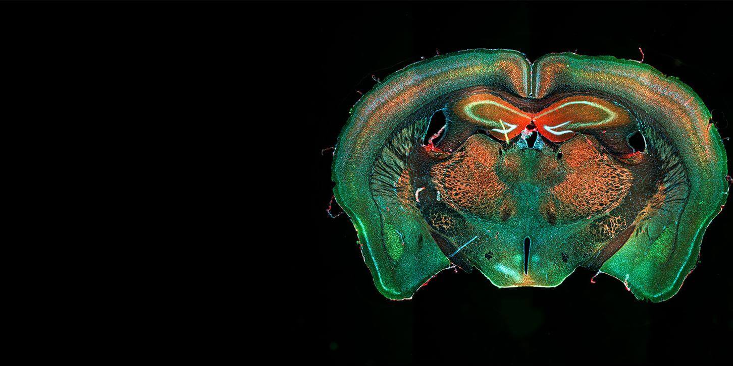 蔡司 Axio Zoom.V16 for Biology